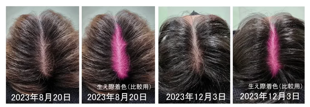 薄毛改善の比較イメージ